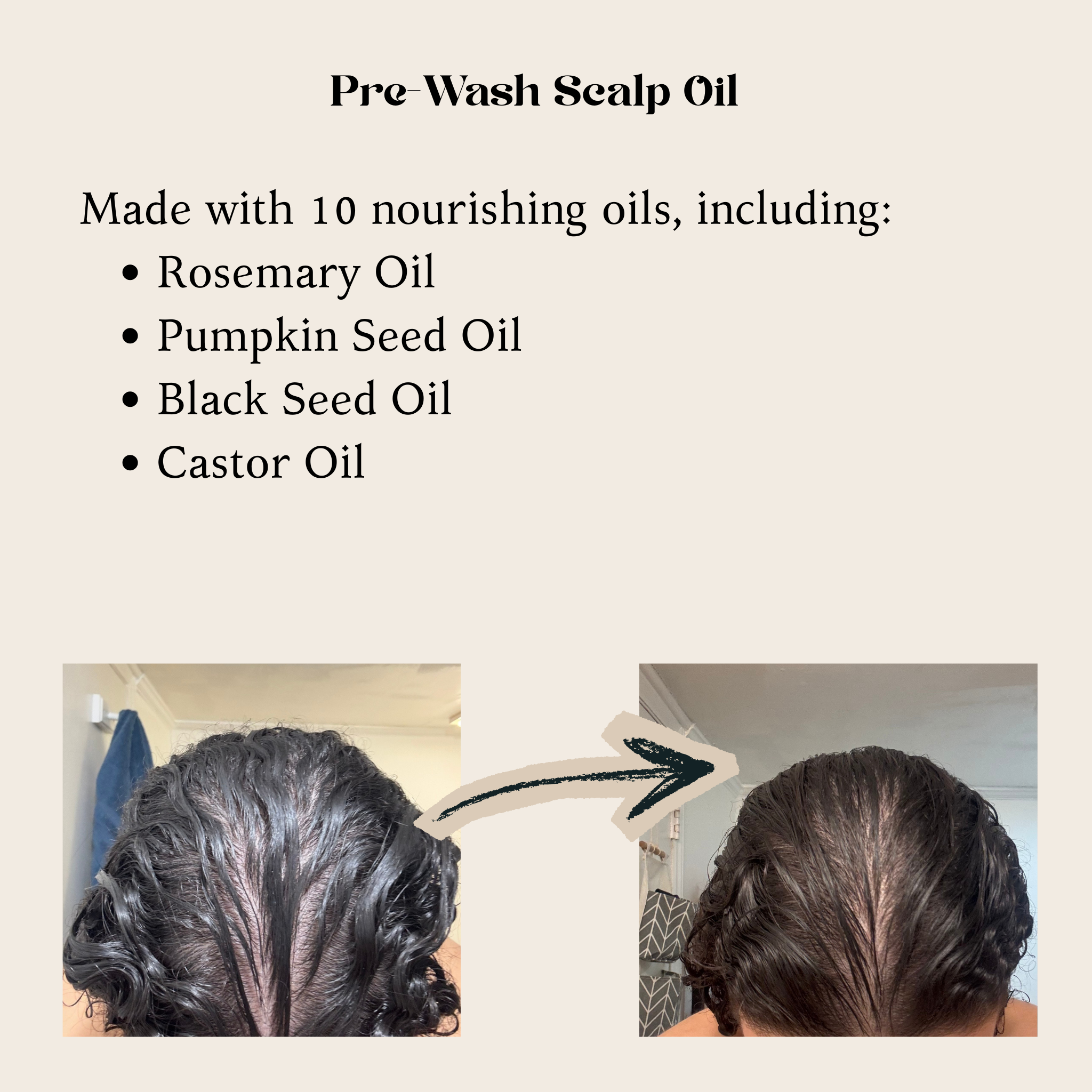 Oraroot Scalp Boosting Drops | Hair Growth Pre-Wash  Scalp Oil (50mL)